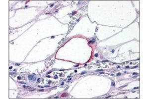 Human Adipocytes: Formalin-Fixed, Paraffin-Embedded (FFPE) (TRIM7 anticorps  (C-Term))