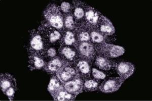 Immunofluorescence staining of A431 cells (Human epithelial carcinoma, ATCC CRL-1555). (BID anticorps  (AA 50-62))