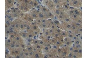 Detection of NNMT in Human Liver Tissue using Polyclonal Antibody to Nicotinamide-N-Methyltransferase (NNMT)