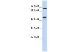 Image no. 1 for anti-Carbohydrate (N-Acetylglucosamine 6-O) Sulfotransferase 6 (CHST6) (AA 288-337) antibody (ABIN6743497) (CHST6 anticorps  (AA 288-337))