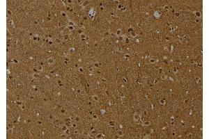 ABIN6274016 at 1/100 staining Rat brain tissue by IHC-P. (Histone H2A anticorps  (acLys9))