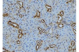 ABIN6272878 at 1/100 staining Mouse kidney tissue by IHC-P. (PLOD3 anticorps  (C-Term))