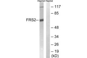 Western blot analysis of extracts from HepG2 cells, using FRS2 (epitope around residue 196) antibody. (FRS2 anticorps  (Tyr196))