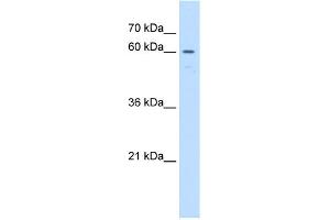 WB Suggested Anti-UNCX Antibody Titration:  1 ug/ml  Positive Control:  Jurkat cell lysate (UNCX anticorps  (C-Term))