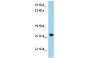 Image no. 1 for anti-PHD Finger Protein 23 (PHF23) (AA 191-240) antibody (ABIN6748146) (PHF23 anticorps  (AA 191-240))