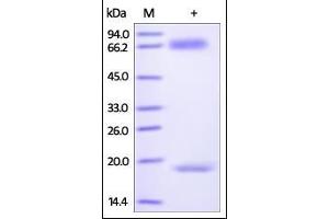 Biotinylated Human PCSK9 on SDS-PAGE under reducing (R) condition. (PCSK9 Protein (AA 31-692) (His tag,AVI tag,Biotin))