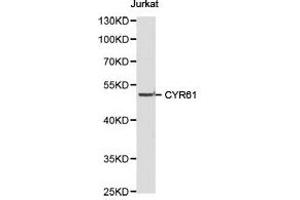 Western Blotting (WB) image for anti-Cysteine-Rich, Angiogenic Inducer, 61 (CYR61) antibody (ABIN1872182) (CYR61 anticorps)