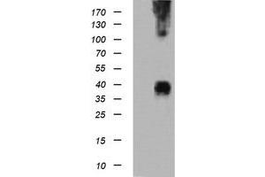 Image no. 1 for anti-Mitogen-Activated Protein Kinase Kinase 3 (MAP2K3) antibody (ABIN1499412) (MAP2K3 anticorps)