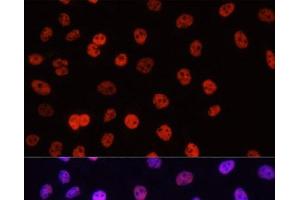 Immunofluorescence analysis of HeLa cells using Asymmetric DiMethyl-Histone H3-R17 Polyclonal Antibody at dilution of 1:100.