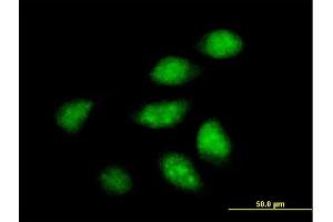 Immunofluorescence of purified MaxPab antibody to ARFIP2 on HeLa cell. (ARFIP2 anticorps  (AA 1-341))