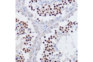 Immunohistochemistry of paraffin-embedded mouse testis using PPARD Rabbit pAb (ABIN6132423, ABIN6146002, ABIN6146003 and ABIN6221300) at dilution of 1:50 (40x lens).