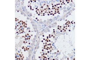 Immunohistochemistry of paraffin-embedded mouse testis using PPARD Rabbit pAb (ABIN6132423, ABIN6146002, ABIN6146003 and ABIN6221300) at dilution of 1:50 (40x lens). (PPARD anticorps  (AA 102-361))