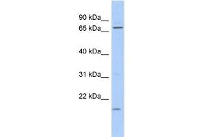 WB Suggested Anti-FUBP3 Antibody Titration: 0. (FUBP3 anticorps  (N-Term))