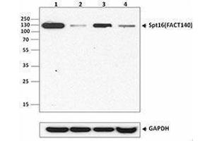 Western Blotting (WB) image for anti-FACT complex subunit SPT16 (SUPT16H) antibody (ABIN2666086) (SUPT16H anticorps)