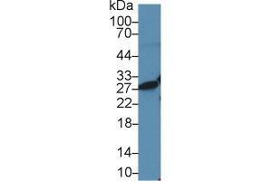 Western Blot; Sample: Human Jurkat cell lysate; Primary Ab: 2µg/ml Rabbit Anti-Rat HMG1 Antibody Second Ab: 0.