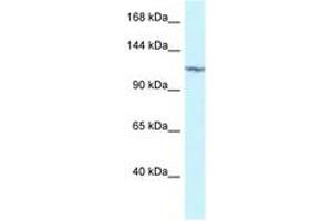 Image no. 1 for anti-Protein Kinase N2 (PKN2) (AA 605-654) antibody (ABIN6747330) (PKN2 anticorps  (AA 605-654))