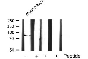 Western blot analysis of STAT3 expression in Mouse liver lysate (STAT3 anticorps  (C-Term))