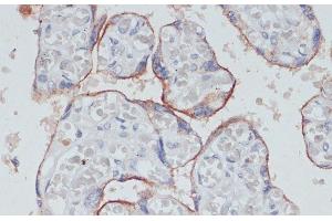Immunohistochemistry of paraffin-embedded Human placenta using TFRC Polyclonal Antibody at dilution of 1:100 (40x lens).