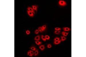 Immunofluorescent analysis of Atlastin-1 staining in A549 cells. (ATL1 anticorps)