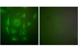 Immunofluorescence analysis of HepG2 cells, using Keratin 7 antibody (ABIN5976442).