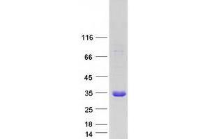 Validation with Western Blot