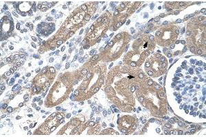 Immunohistochemistry (IHC) image for anti-Tryptophan 2,3-Dioxygenase (TDO2) (N-Term) antibody (ABIN2782334)