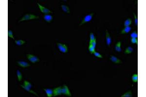 Immunofluorescent analysis of Hela cells using ABIN7152982 at dilution of 1:100 and Alexa Fluor 488-congugated AffiniPure Goat Anti-Rabbit IgG(H+L)