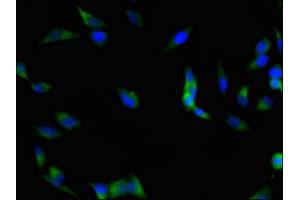 Immunofluorescent analysis of Hela cells using ABIN7152982 at dilution of 1:100 and Alexa Fluor 488-congugated AffiniPure Goat Anti-Rabbit IgG(H+L) (FAK anticorps  (AA 363-464))