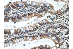 Immunohistochemical staining of formalin-fixed paraffin-embedded human fetal small intestine tissue showing cytoplasmic staining with NUDT7 polyclonal antibody  at 1 : 100 dilution. (NUDT7 anticorps  (AA 2-236))