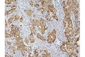 IHC analysis of CDK5 using anti-CDK5 antibody (ABIN6719393). (CDK5 anticorps  (AA 1-226))