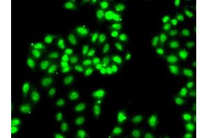 Immunofluorescence analysis of A549 cells using HNRNPA1 antibody. (HNRNPA1 anticorps)
