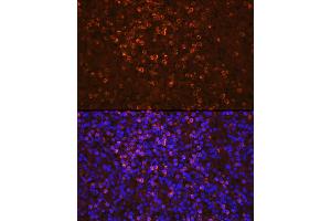 Immunofluorescence analysis of human spleen cells using Lipocalin-2/NGAL Rabbit pAb (ABIN3022890, ABIN3022891, ABIN3022892 and ABIN6219282) at dilution of 1:100 (40x lens). (Lipocalin 2 anticorps  (AA 21-198))