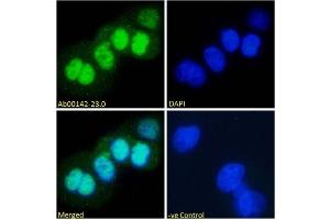 Immunofluorescence staining of fixed A431 with anti-p53 antibody (ABIN5668085) Immunofluorescence analysis of paraformaldehyde fixed A431 cells, permeabilized with 0.