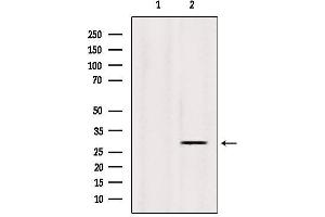 Western blot analysis of extracts from Sp2/0, using INSIG1 Antibody. (INSIG1 anticorps  (Internal Region))