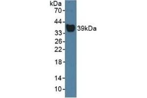Detection of Hpt in Rat Serum using Polyclonal Antibody to Haptoglobin (Hpt) (Haptoglobin anticorps  (AA 70-332))
