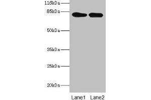 Western blot All lanes: LHCGR antibody at 2 μg/mL Lane 1: Mouse brain tissue Lane 2: Mouse kidney tissue Secondary Goat polyclonal to rabbit IgG at 1/10000 dilution Predicted band size: 79, 72 kDa Observed band size: 79 kDa (LHCGR anticorps  (AA 27-363))