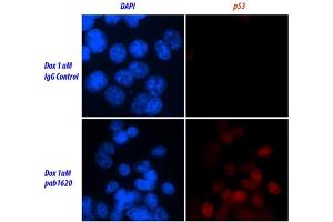 Image no. 2 for anti-Tumor Protein P53 (TP53) (Wild Type) antibody (ABIN2704419) (p53 anticorps  (Wild Type))