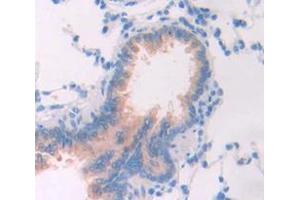IHC-P analysis of Rat Tissue, with DAB staining. (FGL2 anticorps  (AA 263-424))