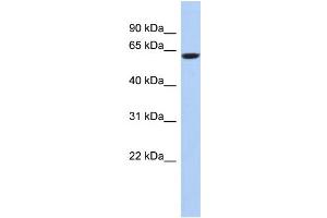 WB Suggested Anti-CAMKV Antibody Titration: 0. (CAMKV anticorps  (N-Term))