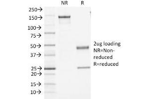SDS-PAGE Analysis Purified CD45 Monoclonal Antibody (PTPRC/1461). (CD45 anticorps)