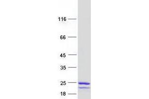 Validation with Western Blot