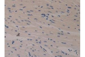 Detection of KL in Mouse Heart Tissue using Polyclonal Antibody to Klotho (KL)
