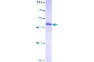 Image no. 1 for Prkr Interacting Protein 1 (IL11 Inducible) (PRKRIP1) (AA 1-184) protein (GST tag) (ABIN1316306)