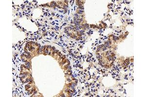 Immunohistochemistry analysis of paraffin-embedded mouse lung using IL22RA1 Polyclonal Antibody at dilution of 1:200. (IL22 Receptor alpha 1 anticorps)