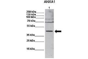 WB Suggested Anti-ANXA1 Antibody    Positive Control:  Lane 1: 20ug mouse fibroblast lysates   Primary Antibody Dilution :   1:600   Secondary Antibody :  Anti rabbit-HRP   Secondry Antibody Dilution :   1:2000   Submitted by:  Anonymous