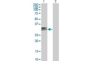Western Blot analysis of HLA-DPA1 expression in transfected 293T cell line by HLA-DPA1 monoclonal antibody (M03), clone 1E3. (HLA-DPA1 anticorps  (AA 1-260))
