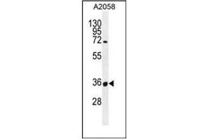 Western blot analysis of OR7G1 Antibody (N-term) in A2058 cell line lysates (35ug/lane). (OR7G1 anticorps  (N-Term))