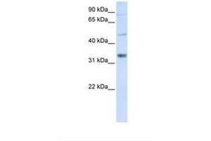 Image no. 1 for anti-Zinc Finger, CCHC Domain Containing 17 (ZCCHC17) (AA 146-195) antibody (ABIN6737801) (ZCCHC17 anticorps  (AA 146-195))
