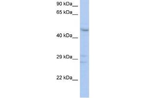 WB Suggested Anti-ACPL2 Antibody Titration:  0. (ACPL2 anticorps  (Middle Region))
