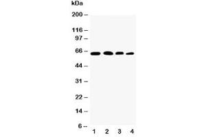 Western blot testing of p65 antibody and Lane 1:  rat testis